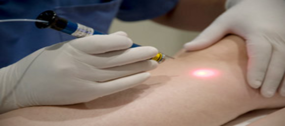 laser_transdermico.html